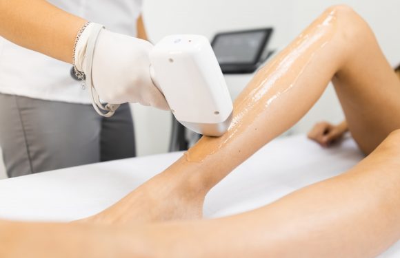 The Latest Advancements In Laser Hair Removal Technology In Tampa