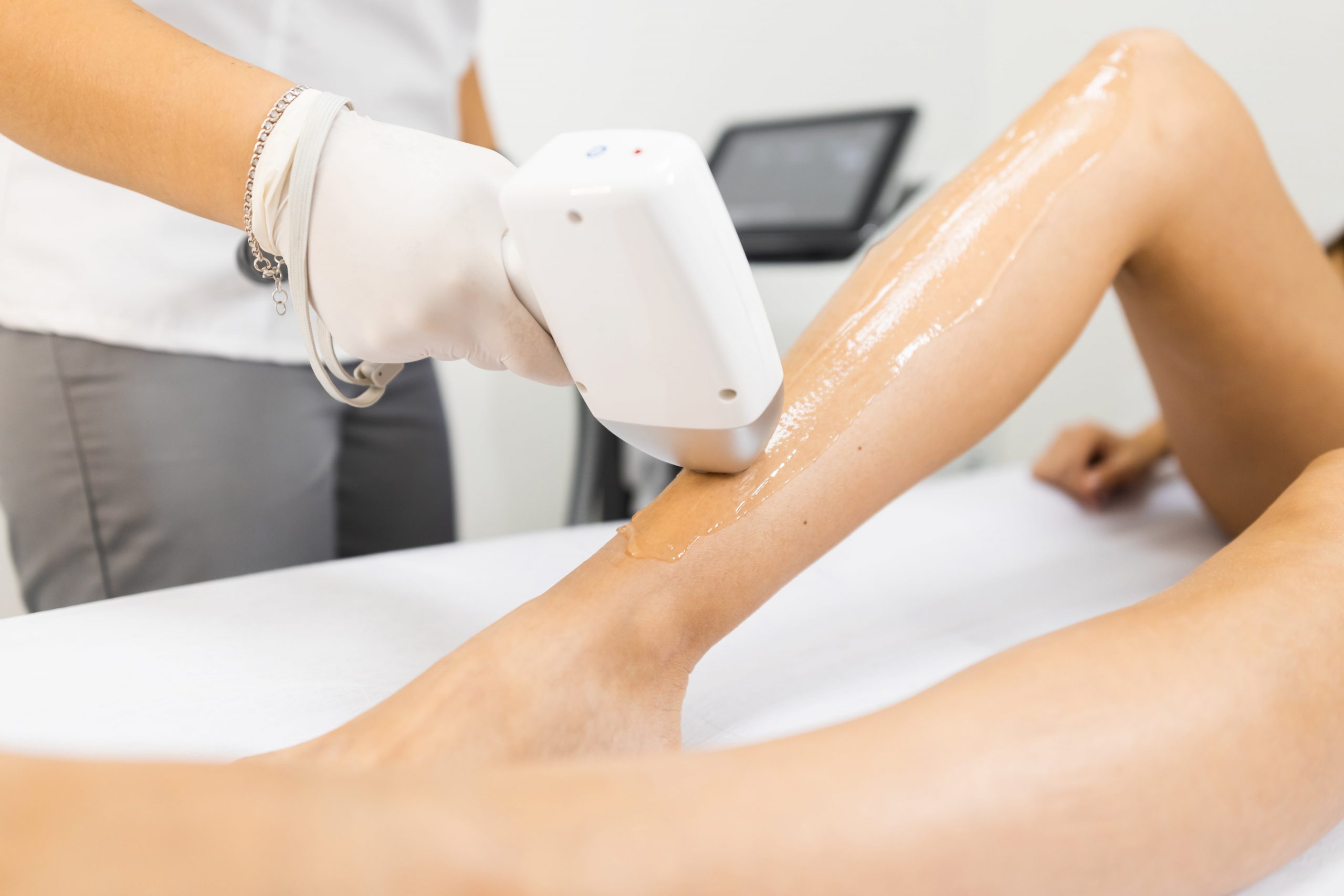 The Latest Advancements In Laser Hair Removal Technology In Tampa